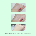 PEPTIDE NO SEBUM MILD GEL CLEANSER - 54e1f-Before-and-After.png