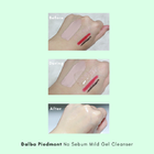 [d'Alba Гель для умывания Peptide No Sebum Mild Gel Cleanser  - 54e1f-Before-and-After.png