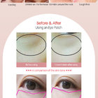 Gold Diamond Honey Rose Gold Hydro gel Eye Patch - a1ce9-05_5.jpg